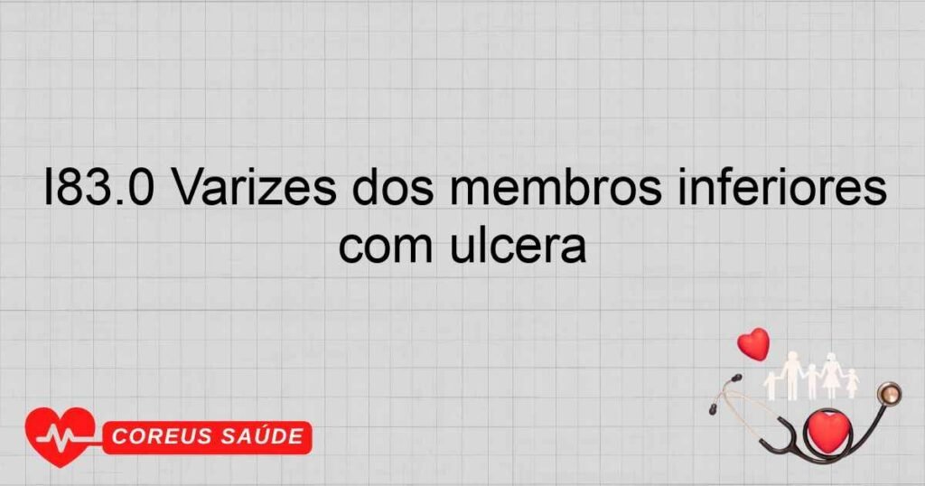 I83.0 Varizes dos membros inferiores com úlcera