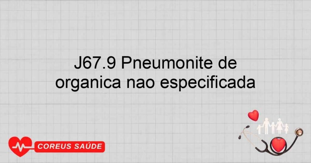 J67.9 Pneumonite de hipersensibilidade devida a poeira orgânica não especificada J67.9 Pneumonite de hipersensibilidade devida a poeira orgânica não especificada
