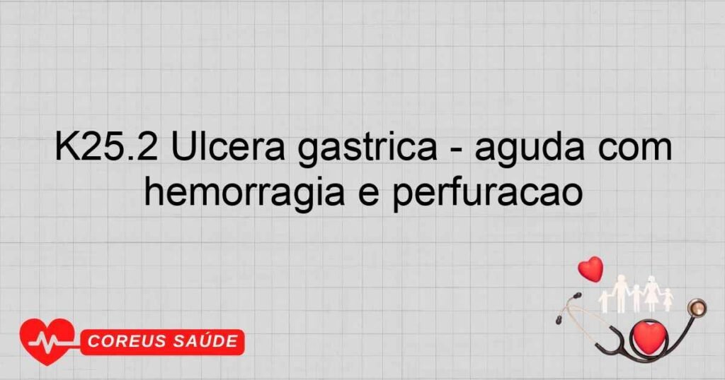 K25.2 Úlcera gástrica ­ aguda com hemorragia e perfuração