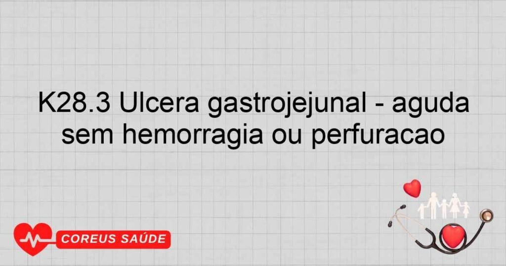 K28.3 Úlcera gastrojejunal ­ aguda sem hemorragia ou perfuração