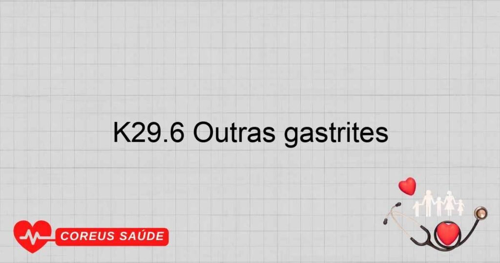 K29.6 Outras gastrites