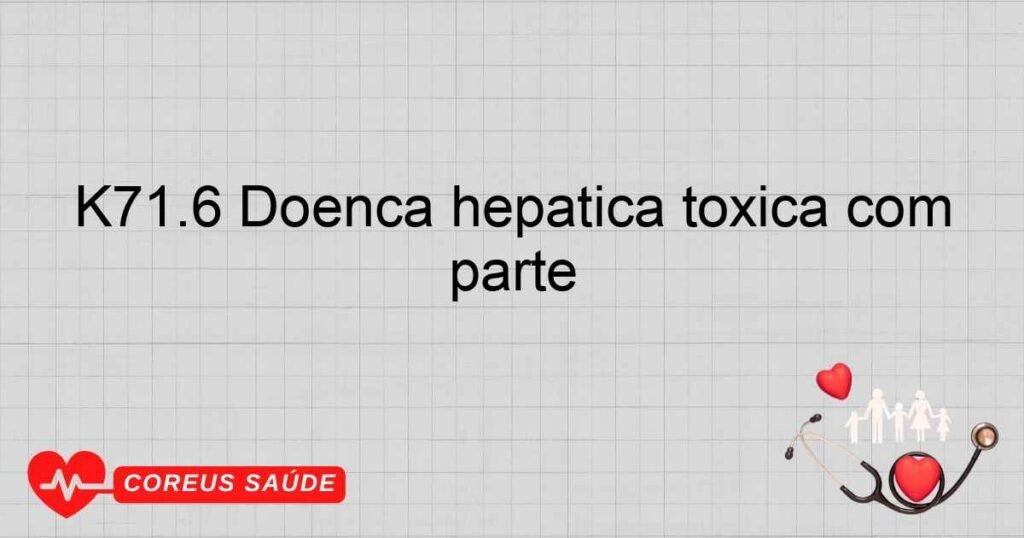 K71.6 Doença hepática tóxica com hepatite não classificada em outra parte