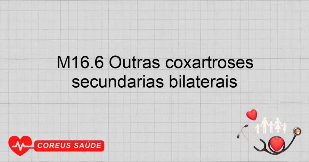 M16.6 Outras coxartroses secundárias bilaterais M16.6 Outras coxartroses secundárias bilaterais