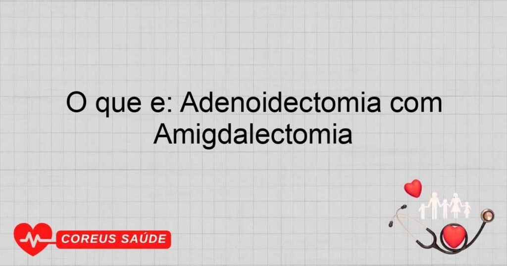 O que é: Adenoidectomia com Amigdalectomia O que é: Adenoidectomia com Amigdalectomia