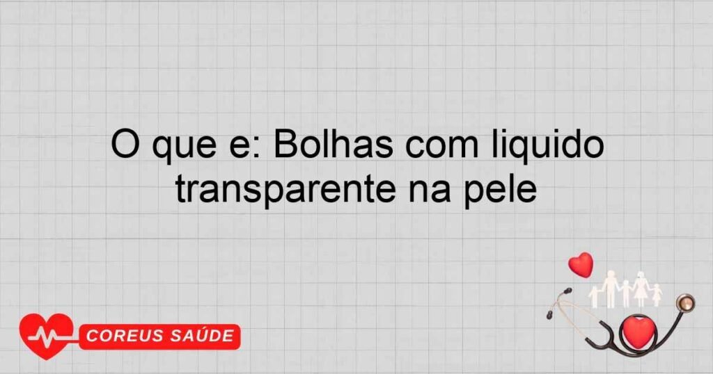 O que é: Bolhas com liquido transparente na pele O que é: Bolhas com liquido transparente na pele