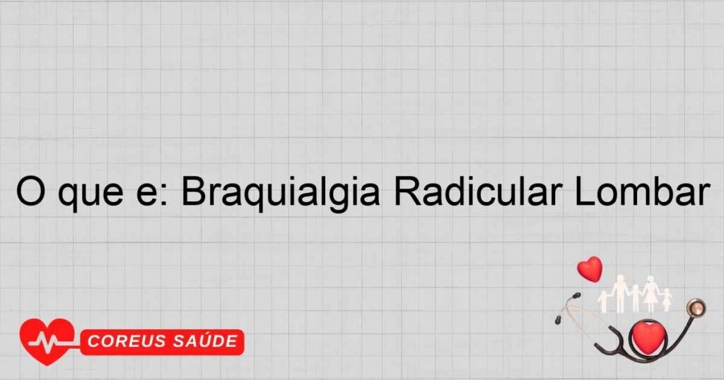 O que é: Braquialgia Radicular Lombar O que é: Braquialgia Radicular Lombar