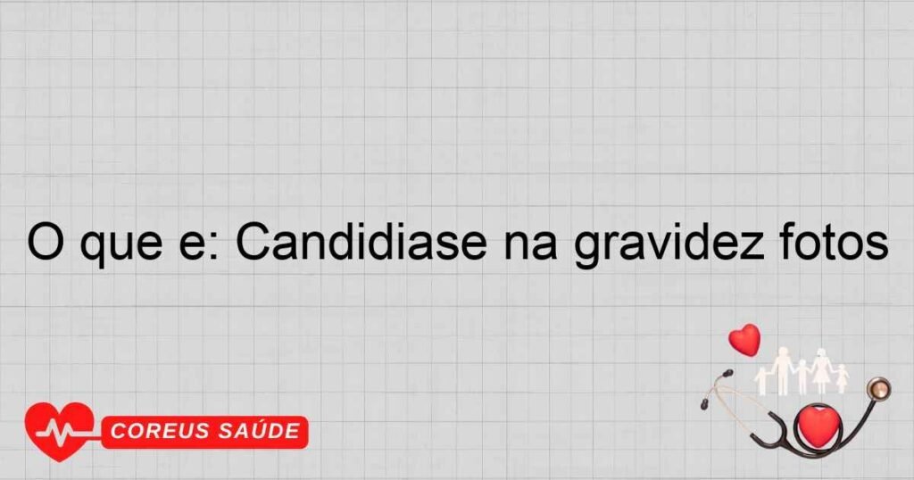 O que é: Candidíase na gravidez fotos O que é: Candidíase na gravidez fotos