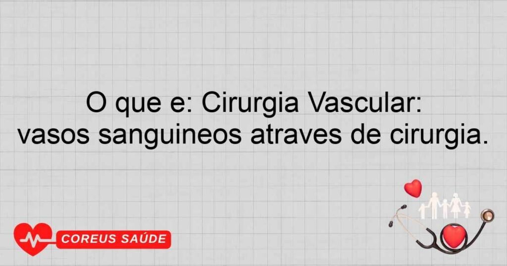 O que é: Cirurgia Vascular: Especialidade que trata doenças dos vasos sanguíneos através de cirurgia.