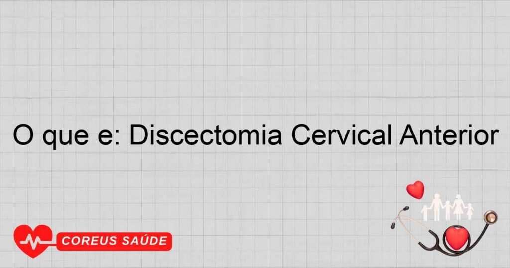 O que é: Discectomia Cervical Anterior