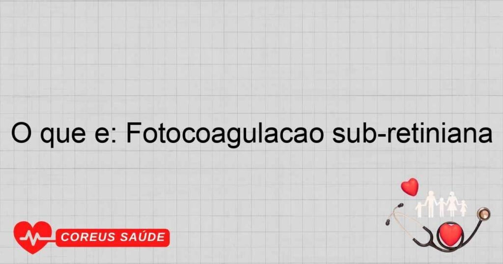 O que é: Fotocoagulação sub-retiniana