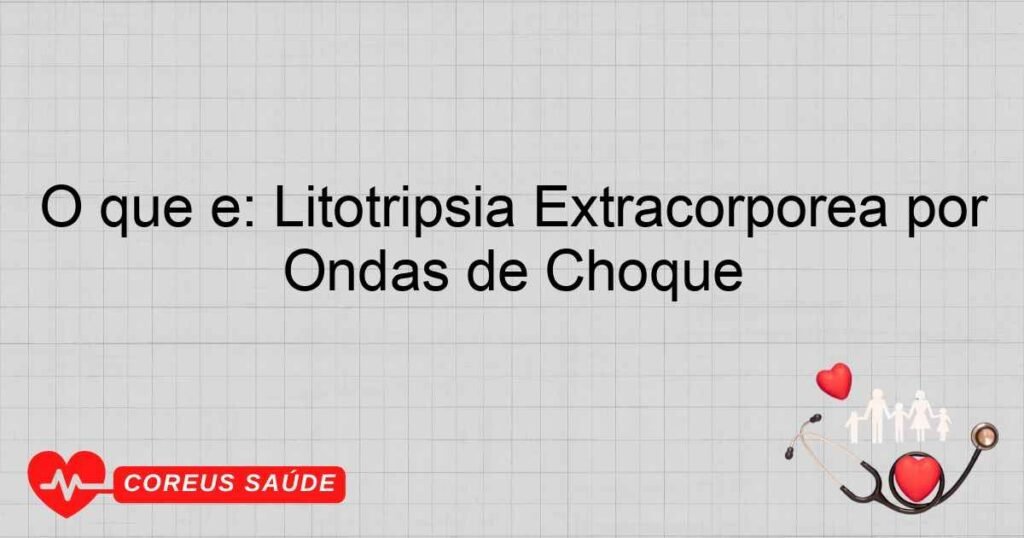 O que é: Litotripsia Extracorpórea por Ondas de Choque O que é: Litotripsia Extracorpórea por Ondas de Choque