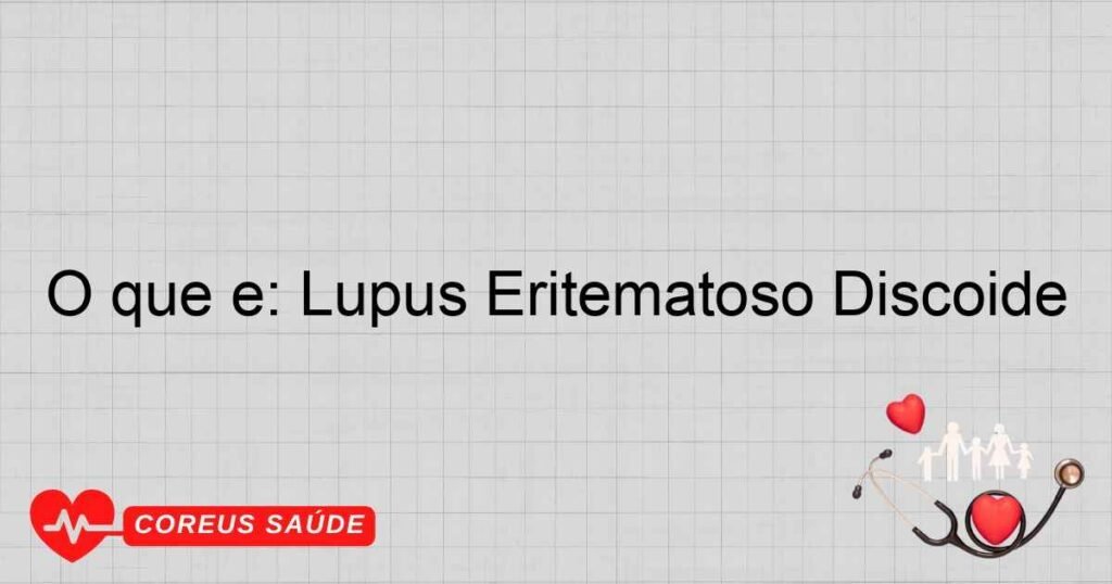 O que é: Lúpus Eritematoso Discoide O que é: Lúpus Eritematoso Discoide