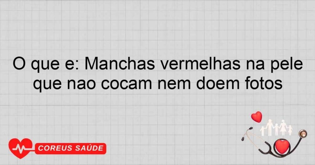 O que é: Manchas vermelhas na pele que não coçam nem doem fotos