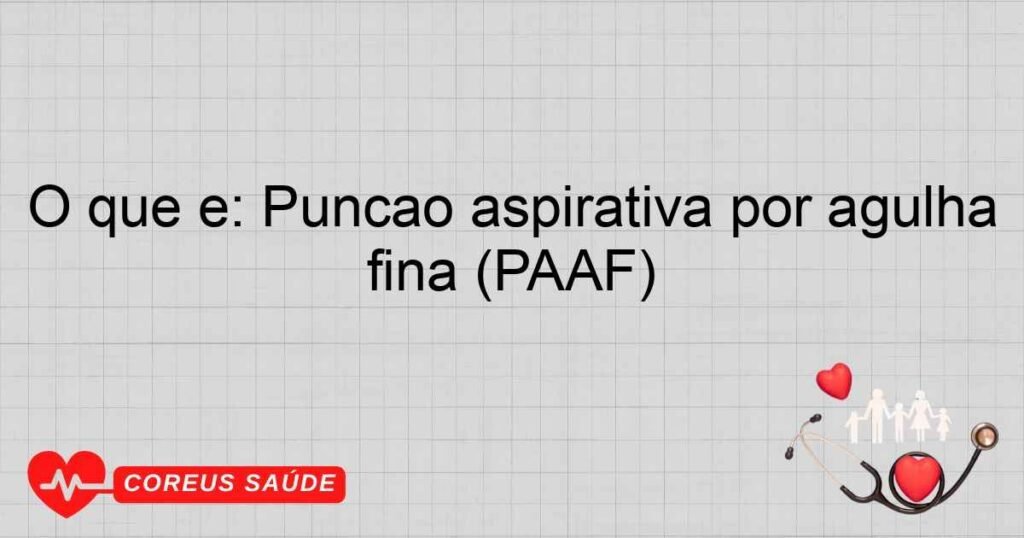 O que é: Punção aspirativa por agulha fina (PAAF) O que é: Punção aspirativa por agulha fina (PAAF)