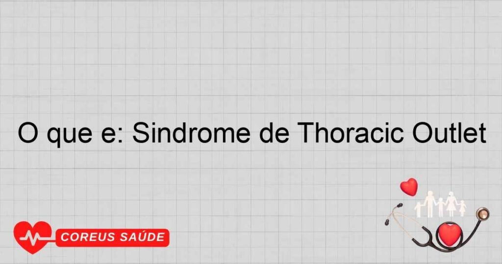 O que é: Síndrome de Thoracic Outlet O que é: Síndrome de Thoracic Outlet