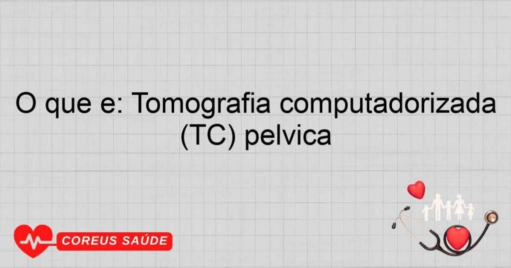 O que é: Tomografia computadorizada (TC) pélvica O que é: Tomografia computadorizada (TC) pélvica