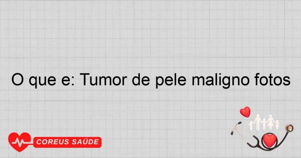 O que é: Tumor de pele maligno fotos