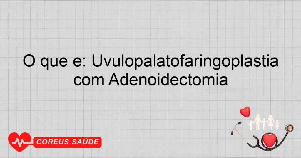 O que é: Uvulopalatofaringoplastia com Adenoidectomia