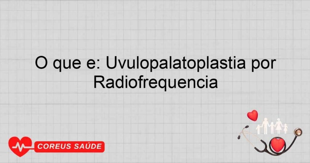 O que é: Uvulopalatoplastia por Radiofrequência