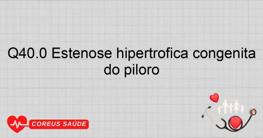 Q40.0 Estenose hipertrófica congênita do piloro