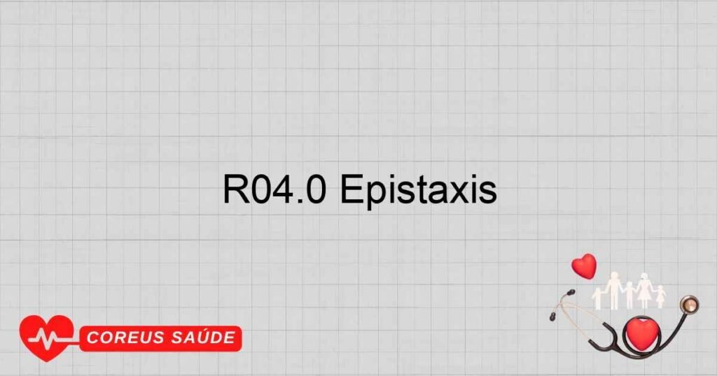 R04.0 Epistaxis