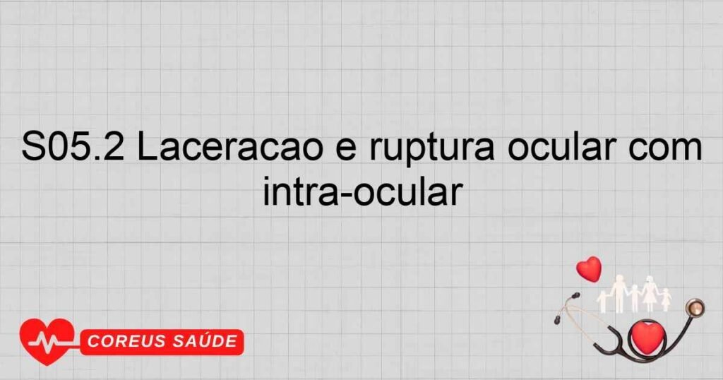 S05.2 Laceração e ruptura ocular com prolapso ou perda de tecido intraocular S05.2 Laceração e ruptura ocular com prolapso ou perda de tecido intraocular