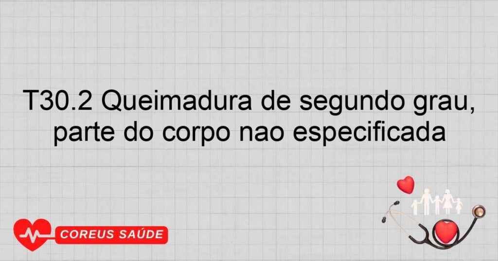 T30.2 Queimadura de segundo grau, parte do corpo não especificada T30.2 Queimadura de segundo grau, parte do corpo não especificada