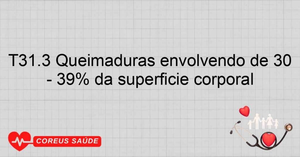 T31.3 Queimaduras envolvendo de 30 ­ 39% da superfície corporal