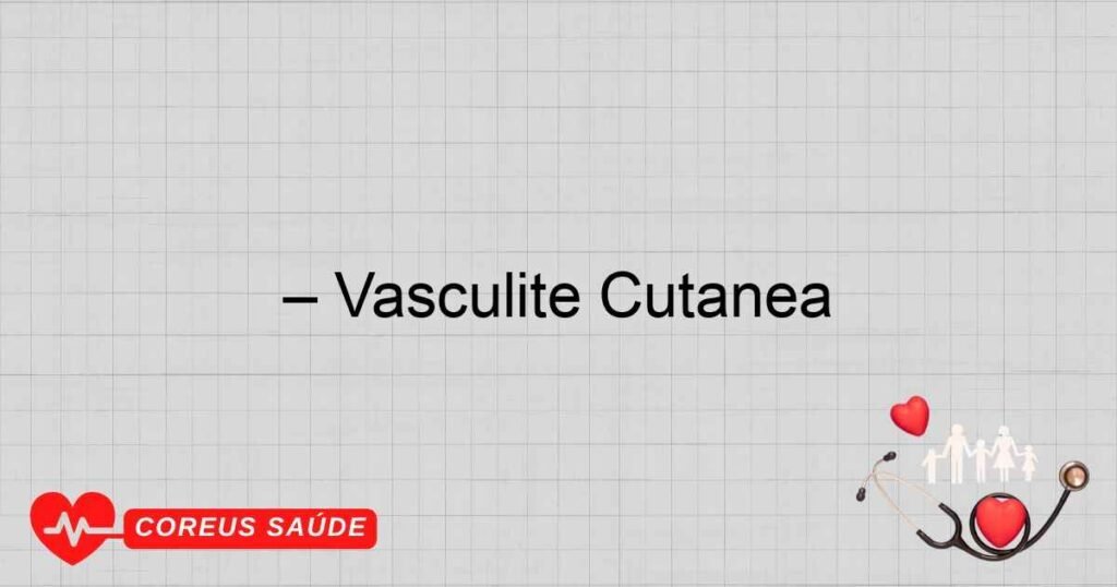 – Vasculite Cutânea – Vasculite Cutânea