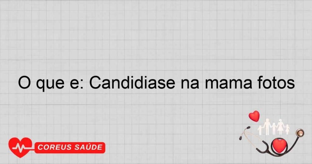 O que é: Candidiase na mama fotos O que é: Candidiase na mama fotos