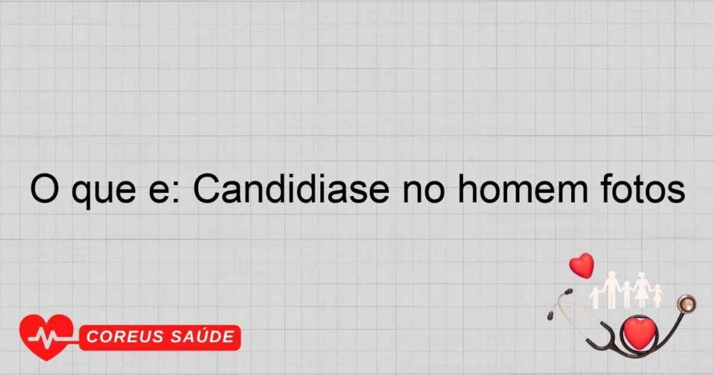 O que é: Candidíase no homem fotos