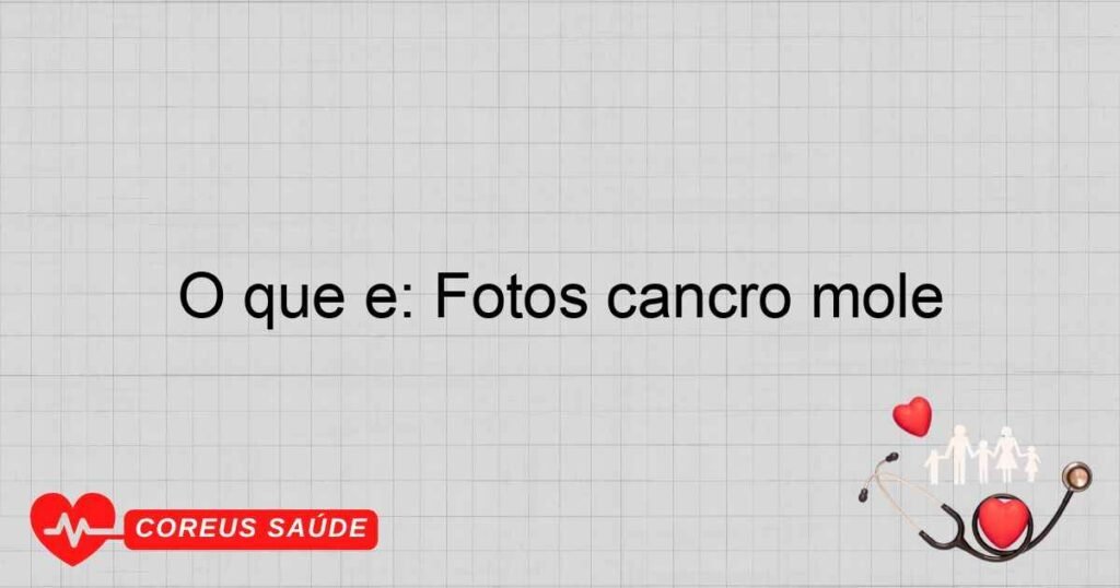 O que é: Fotos cancro mole