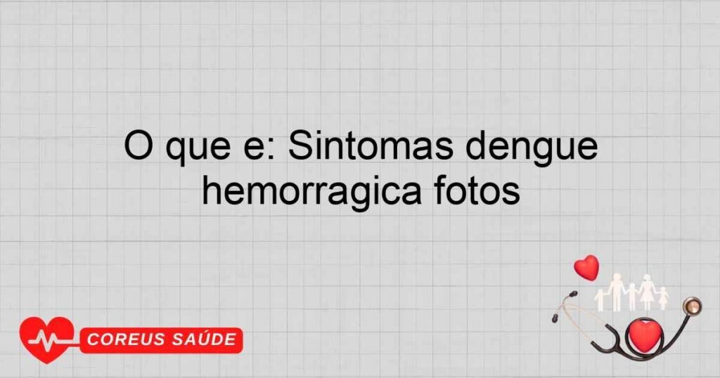 O que é: Sintomas dengue hemorrágica fotos
